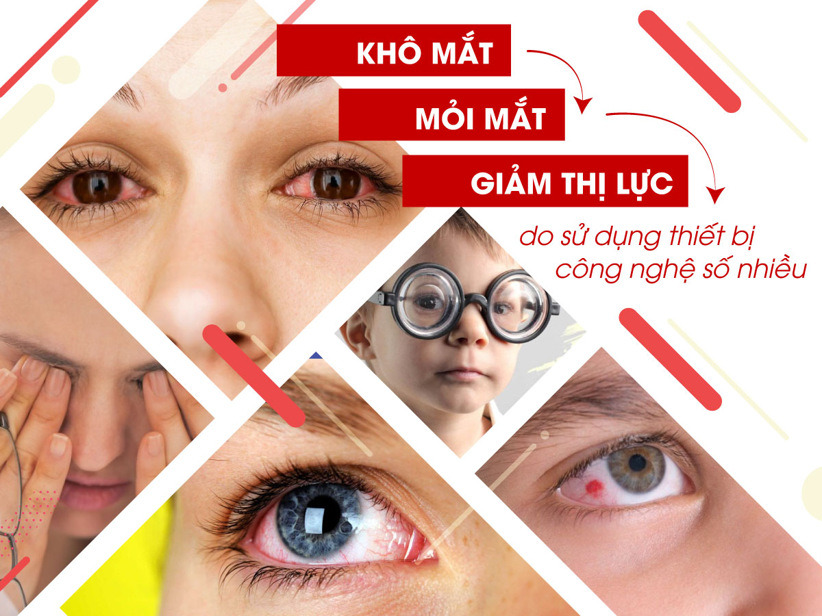 NHỮNG YẾT TỐ GIÚP CHO ĐÔI MẮT KHỎE ĐẸP
